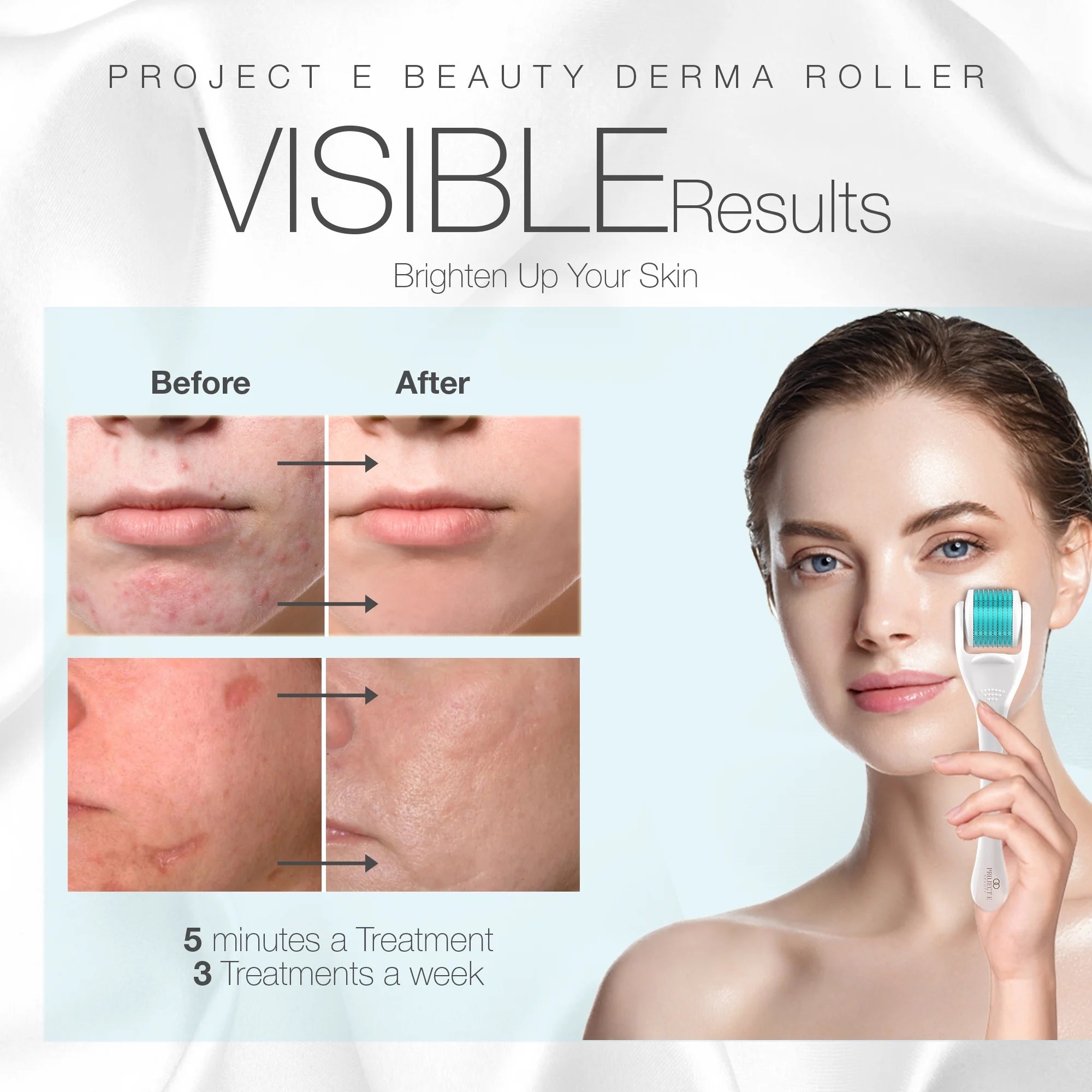 Derma Roller | 540 Titanium Microneedles | Facial & Body Skincare Tool | for Smoother Skin
